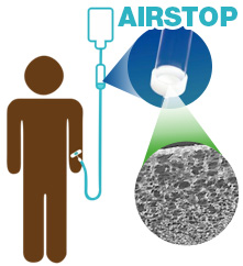 Airstop-infusion-set.jpg